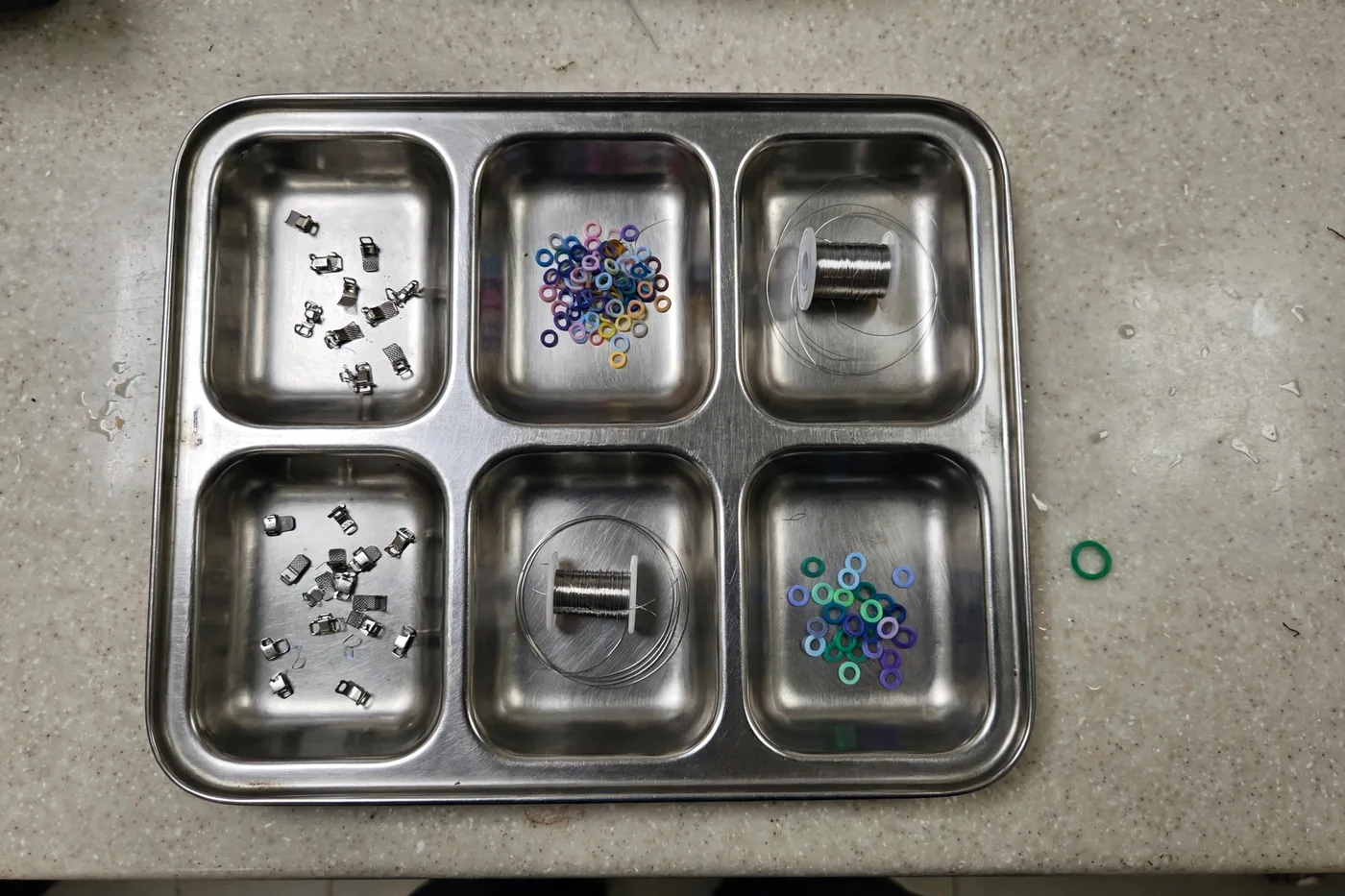 Bracket tray, from above — Brackets, archwire spools and ligatures laid out between patients.